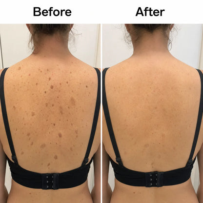 Glycolic Body Stick
